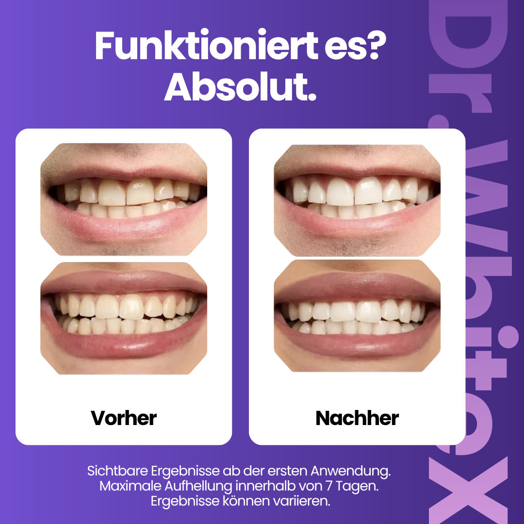 Purple Whitening Strips