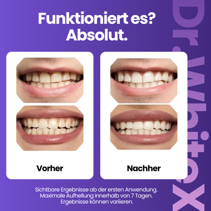 Purple Whitening Strips